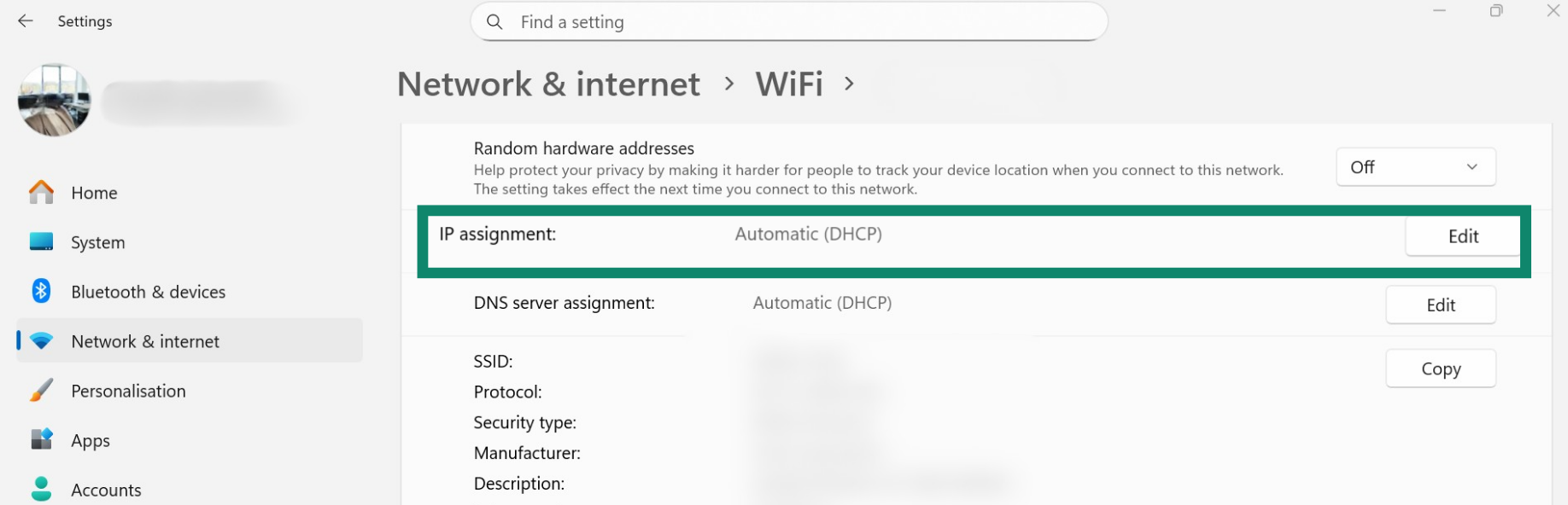 Find IP assignment in Windows.
